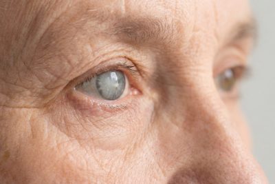 closeup-elderly-persons-eye-with-cataract.jpg