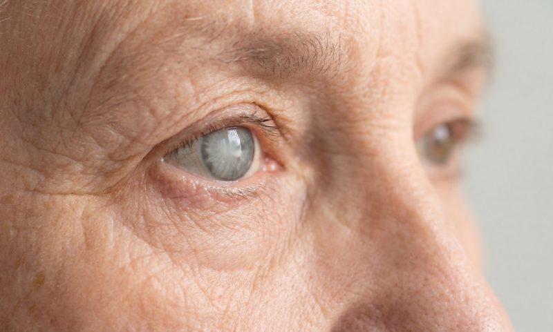 closeup-elderly-persons-eye-with-cataract.jpg